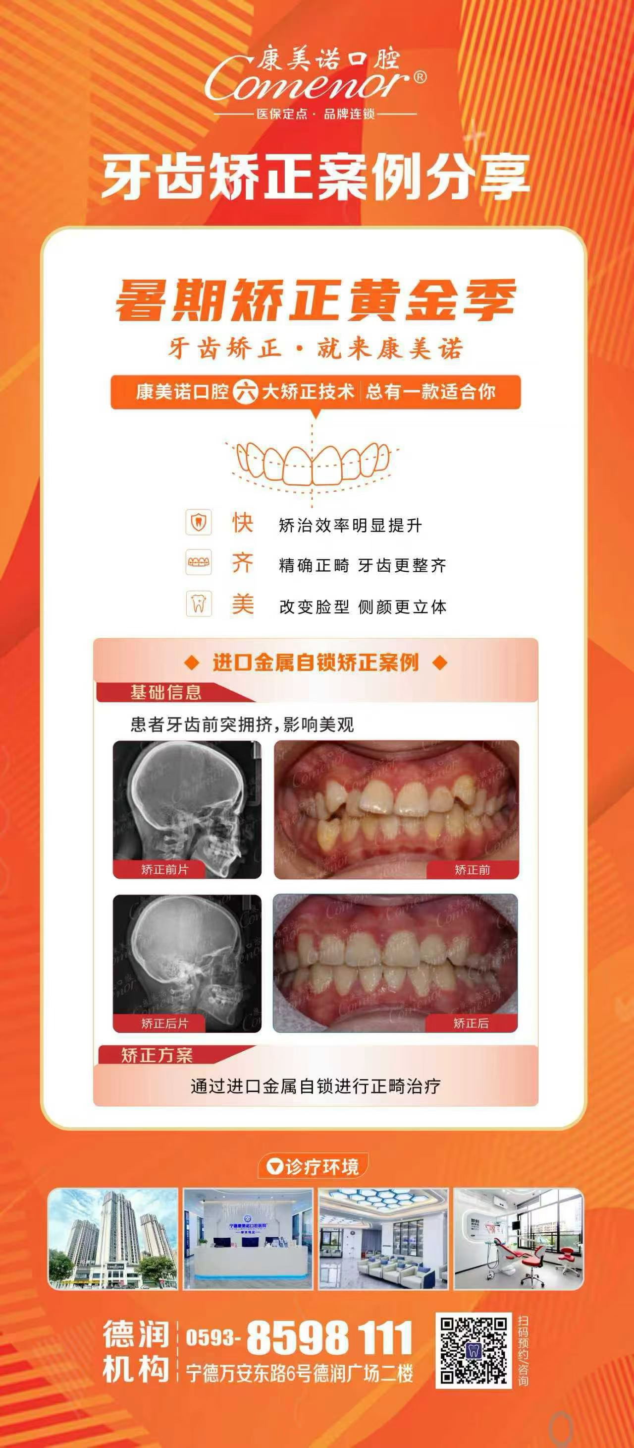 康美诺口腔暑期矫正狂欢季