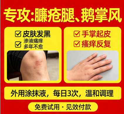 主治臁疮腿